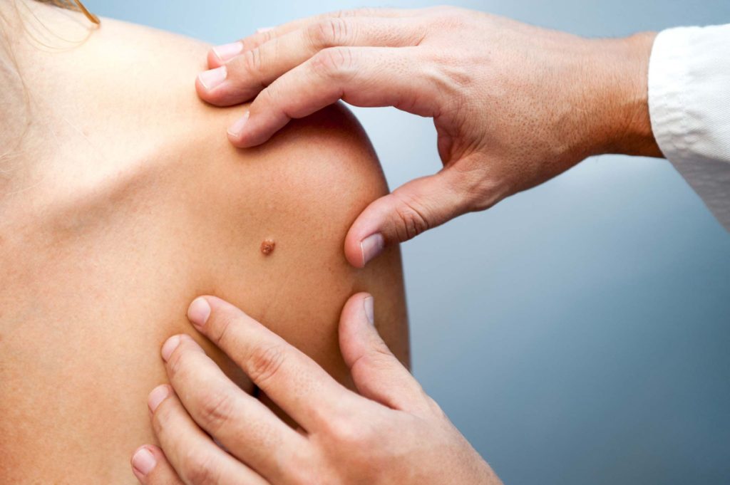 Woman with lesion on her skin being examined by a doctor